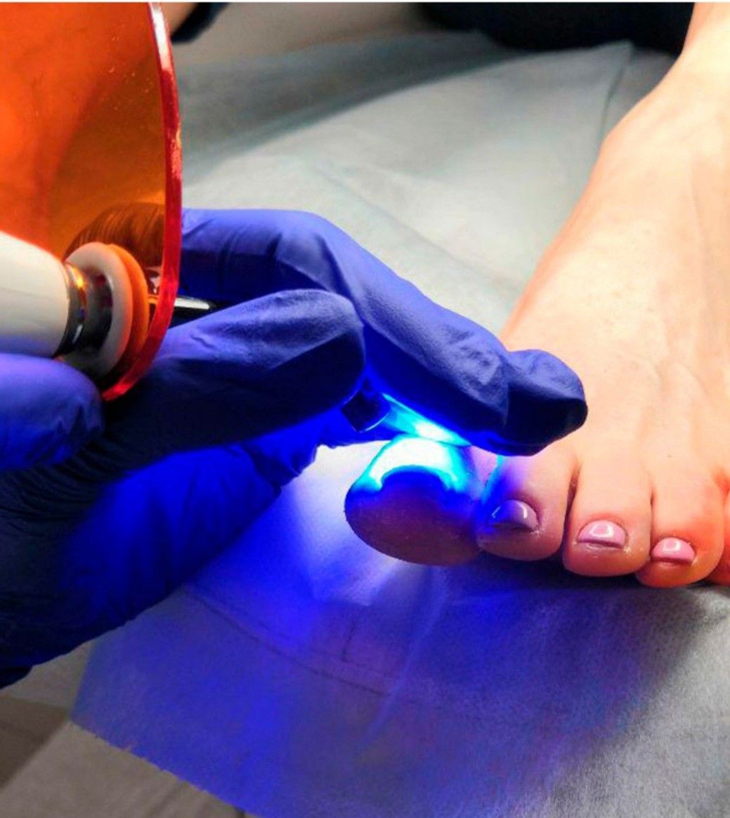 Pedicure Clínico en Pachuca - Podóloga Aurora Pachuca Centro