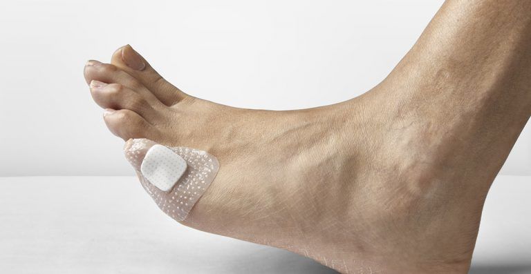 Curaciones Especializadas Pies en Pachuca - Podóloga Aurora